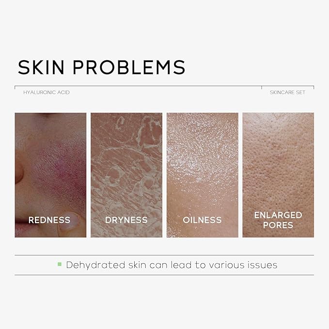 Hydrating Skin Care Set, Hyaluronic Acid