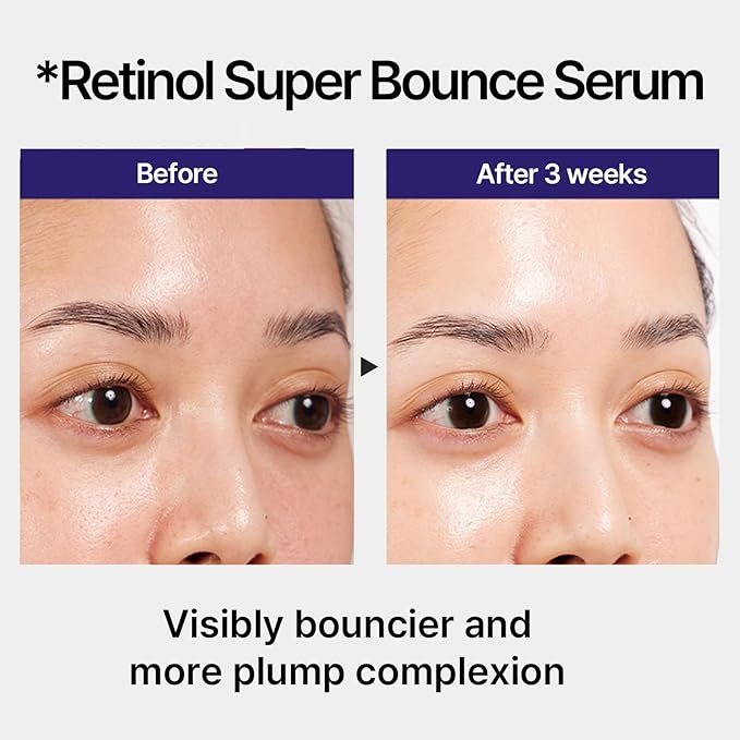 Iope retinol serum super bounce