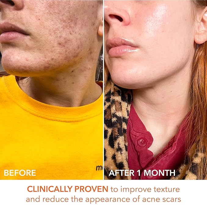 Alpha Beta Universal Daily Peel by Dr. Dennis Gross for Unisex - 60 Pc Pads