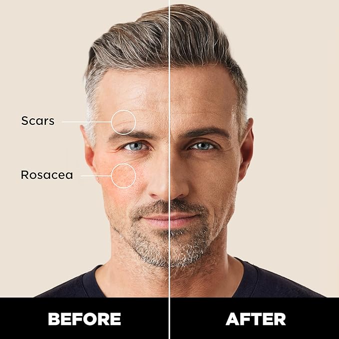 Stryx Concealer Stick Tool for Men, Medium Mahogany Undetectable Coverage