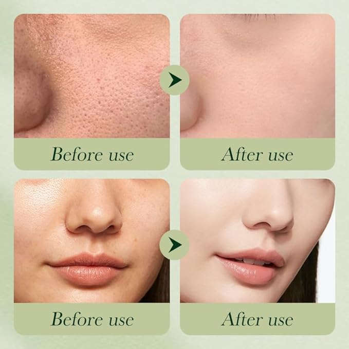 Avocado Skincare Sets, 6Pcs Skincare Gift moisturizing