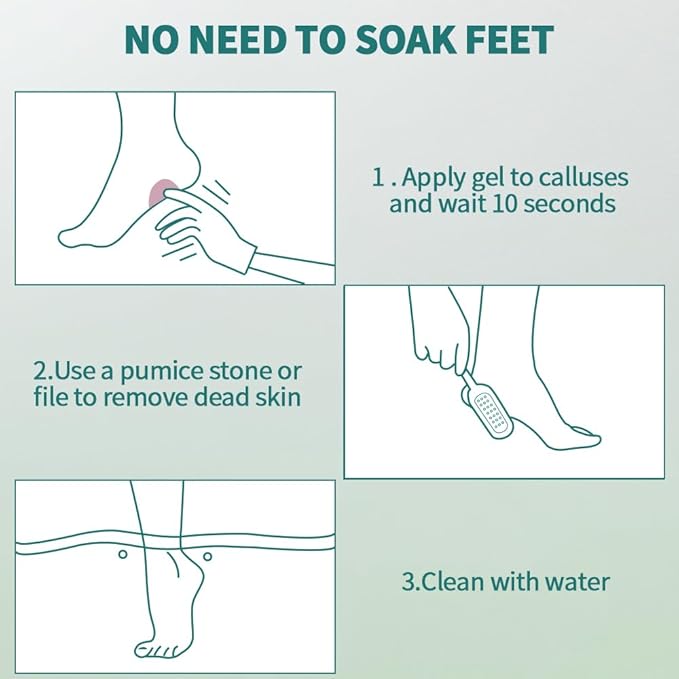 Gorgellux callus remover gel, callus