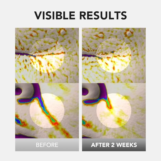 [skin&lab] bakuchiol eye serum with