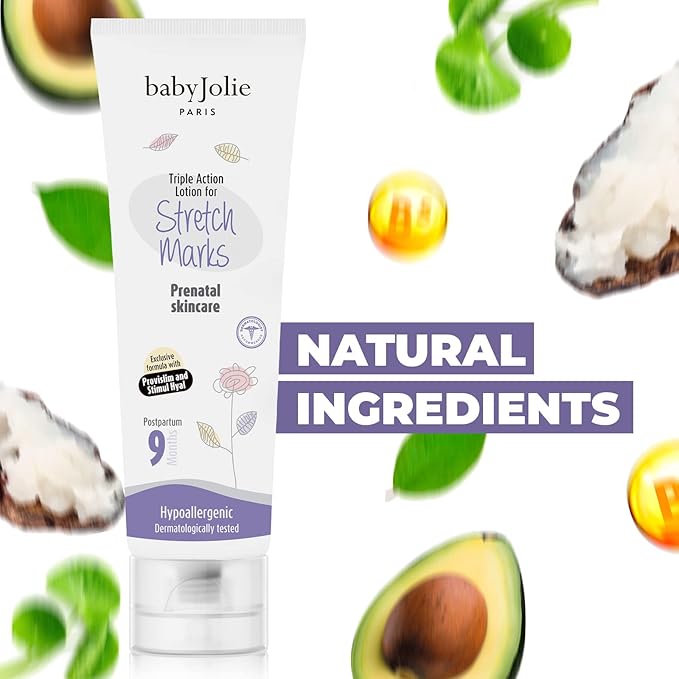 Baby Jolie Stretch Mark Cream