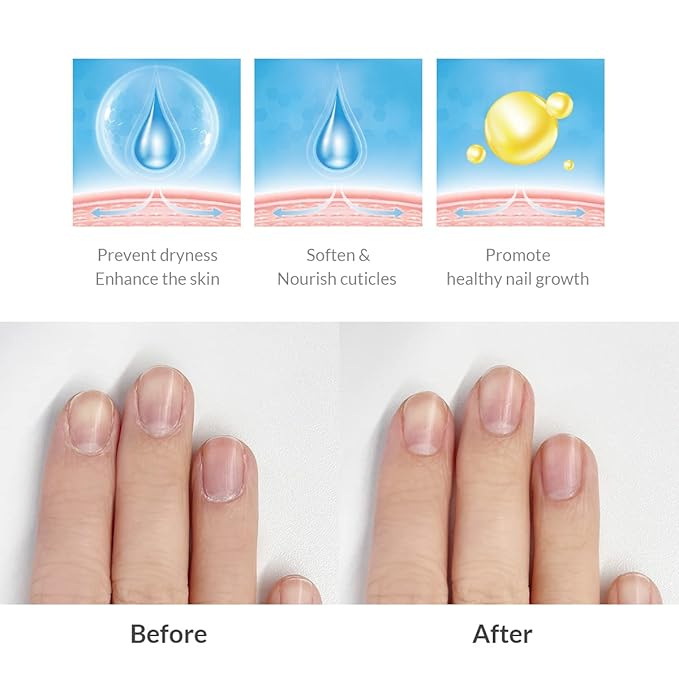 Dr.Althea Dear.A Luminous Nail Essence