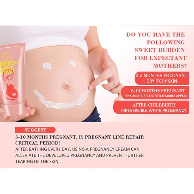 AICHUN BEAUTY Pregnancy Cream Streach Mark 150ml