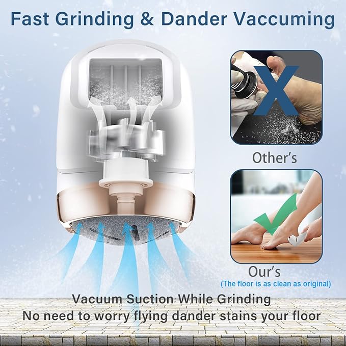 Hoxida electric callus remover for