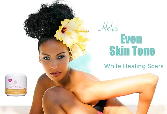 Best Stretch Marks Cream Prevent & Reducing