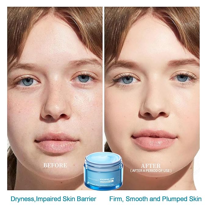Hydro Boost Hyaluronic Acid Face Moisturizer for Oil Skin, Hydro Boost Moisturizer 48-Hour Hydration, Hydro Boost Water Gel Oil-Free and Lightweight Absorbs Well, Plump Skin for Women & Men 1.76oz