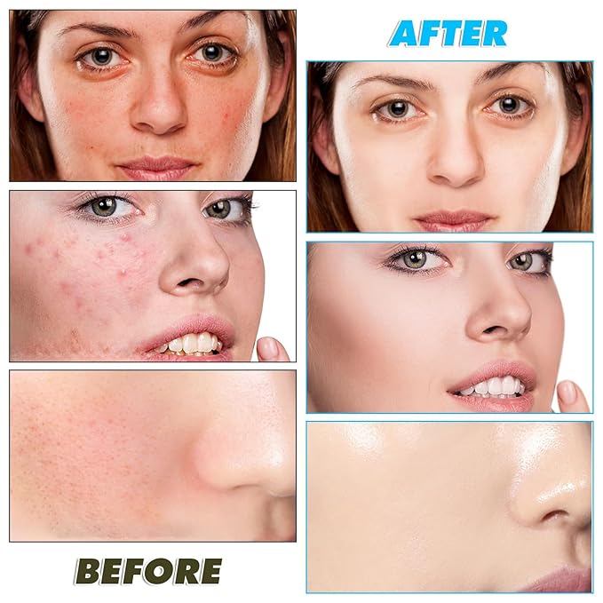 40 pads turmeric cleansing pads