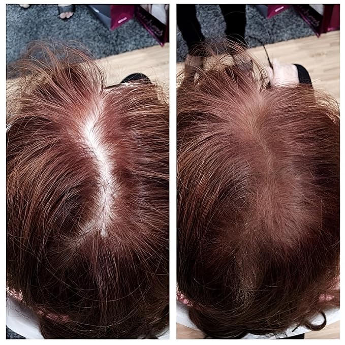 SOVONCARE Instantly Hairline Powder, Hairline