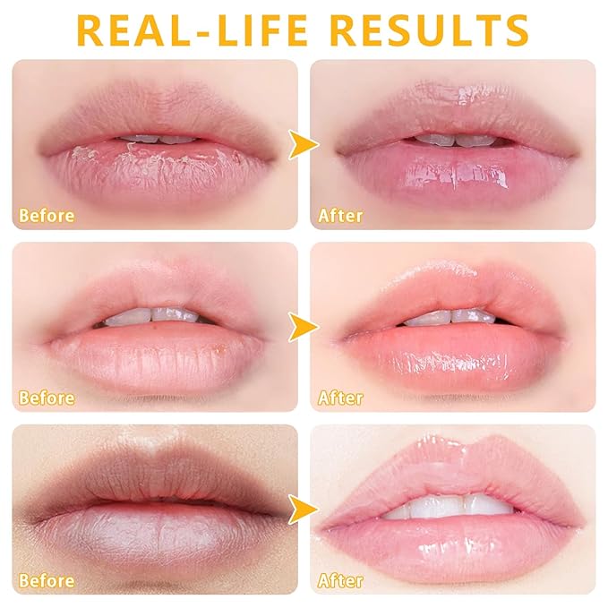 5 PCS Bee Balm Lip Balm