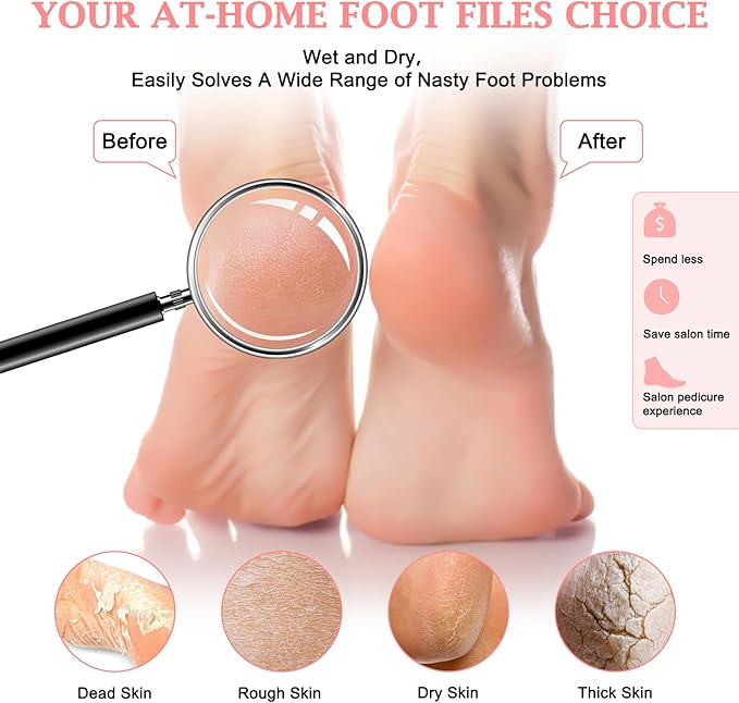 Hofason 4pcs pedicure foot files