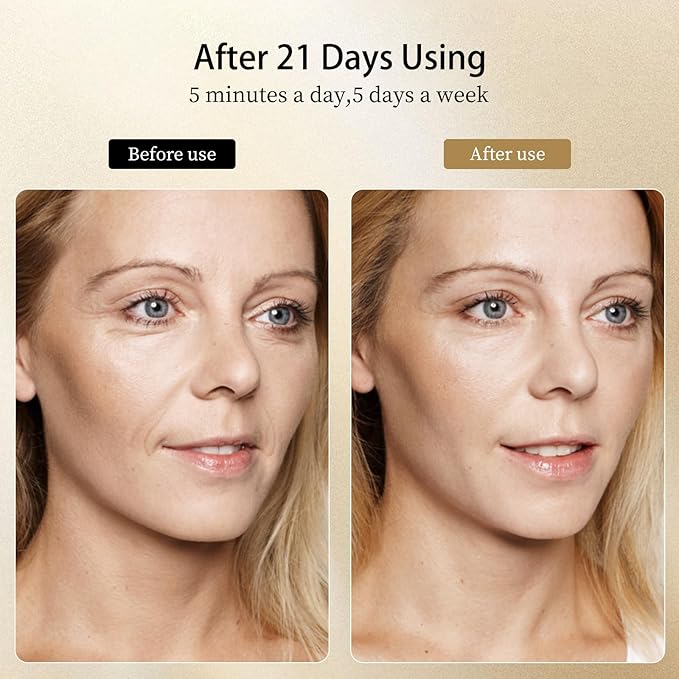 8 Modes&3 Color Facial-Massager-Device(Gold)