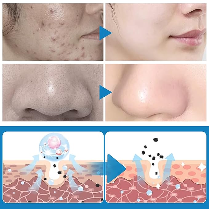 Turmeric cleansing pads for dark