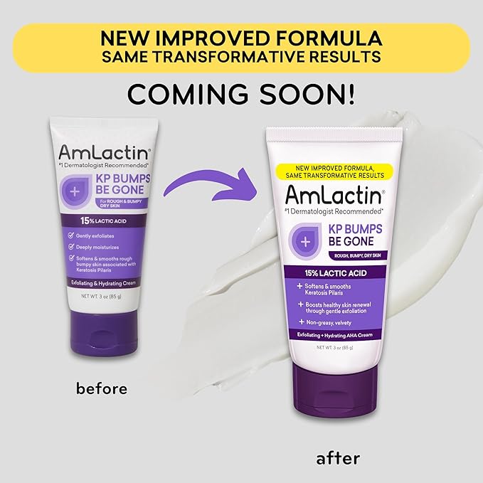AmLactin KP Bumps Be Gone - 3 oz Keratosis Pilaris Moisturizing Cream with 15% Lactic Acid - Exfoliator and Moisturizer for Dry, Rough and Bumpy Skin (Packaging May Vary)