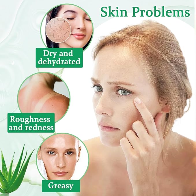 8PCS Aloe Vera Gel for Face & Skin,Organic Aloe Vera Gel,Hydrating After Sun Cream for Travel Size,Moisturizing Lotion for Skincare,After Sun Lotion for All Skin Type(B)