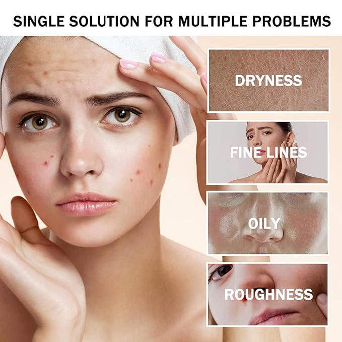 16PCS Travel Size Aloe Vera Gel,Soothing After Sun Lotion for Face and Body,Organic Hydrating Aloe Vera Gel for After Sun Care,Instant Cooling,Refreshing Face Moisturizer Set, 1.05 Oz