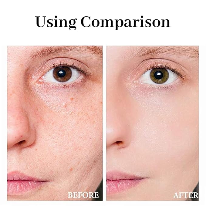 80 pcs kojic acid turmeric