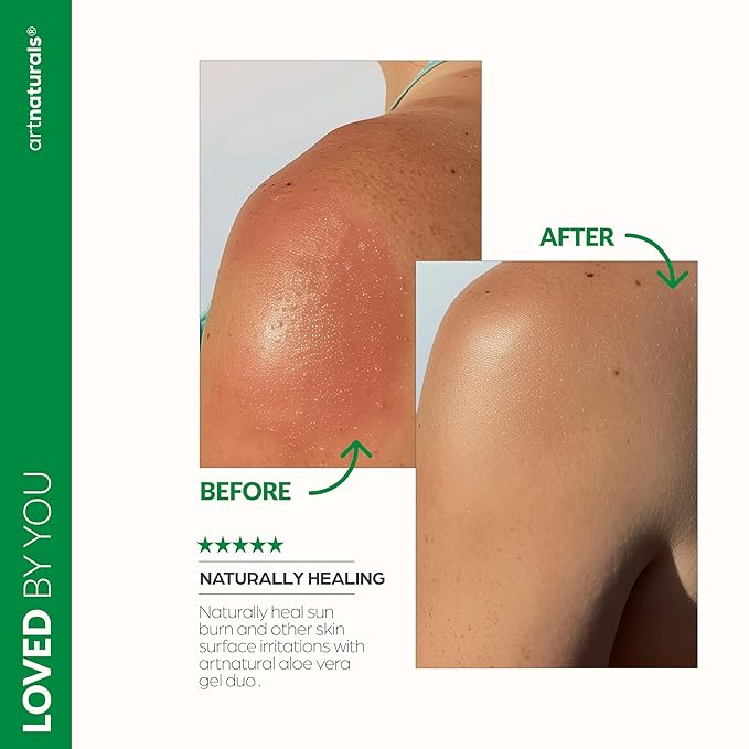 artnaturals Aloe Vera Gel Set - 20oz