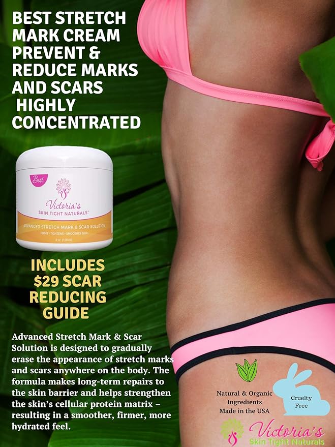 Best Stretch Marks Cream Prevent & Reducing