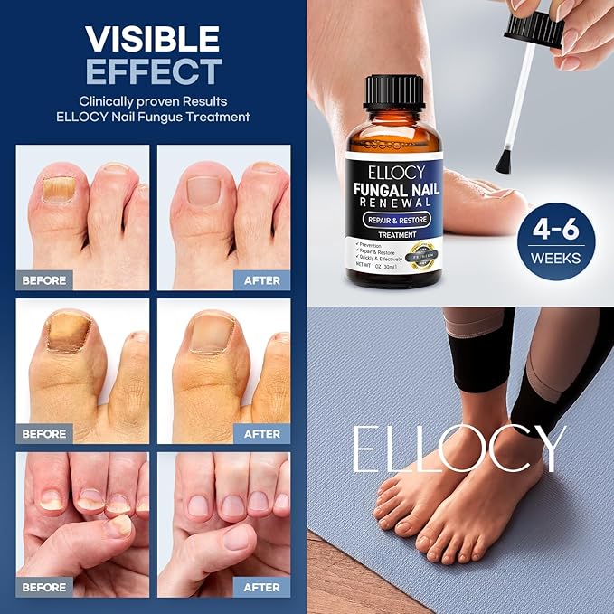 Toenail Fungus Treatment Extra Strength: