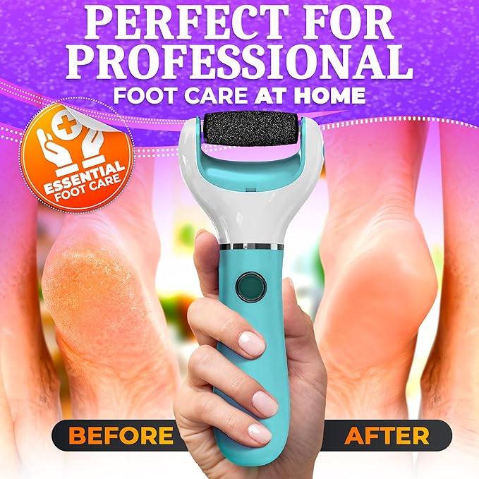 Electric foot callus remover -