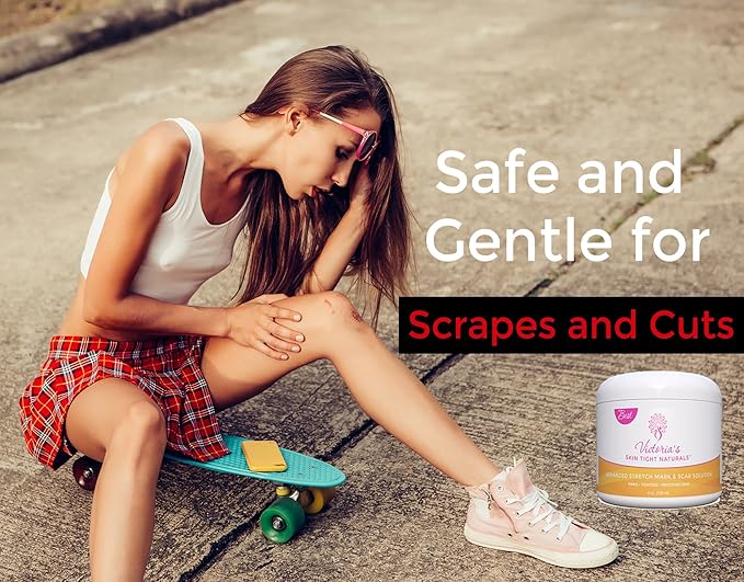 Best Stretch Marks Cream Prevent & Reducing